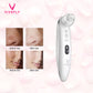 Vivefly Healthcare Blackhead Remover Wit Mee-eters Puisjes Lamore - Vivefly Healthcare
